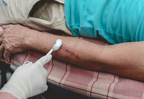 Dog Bite Lawyer Davie Florida